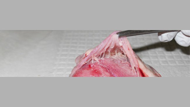 Serce, zapalenei osierdzia obserwowane w uogólnionym zakażeniu M. hyorhinis