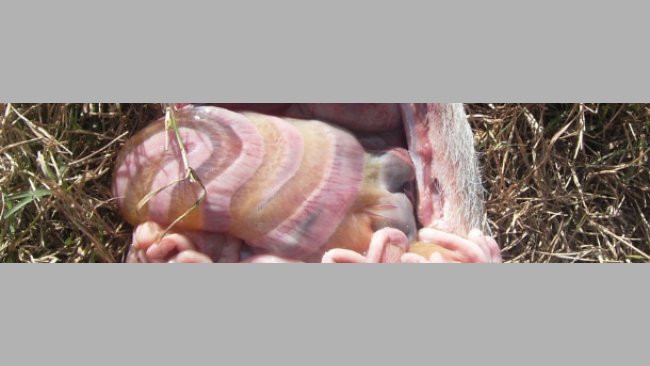 Obrzęk krezki okrężnicy spowodowany zakażeniem E.coli.