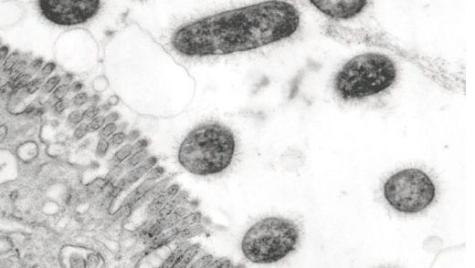 Bakterie ETEC posiadają podobne do włos&oacute;w adhezyny fimbrialne na swojej powierzchni i dzięki nim przylegają do kom&oacute;rek nabłonkowych jelita u świń z biegunką, co wykazano w badaniach przeprowadzonych w mikroskopie elektronowym
