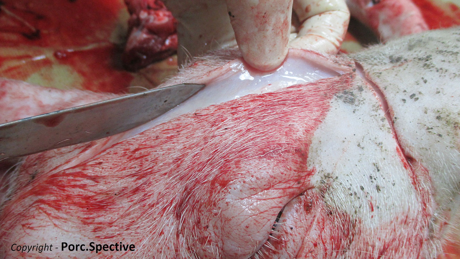 Fot 1. Obrzęk tkanki podsk&oacute;rnej sk&oacute;ry głowy
