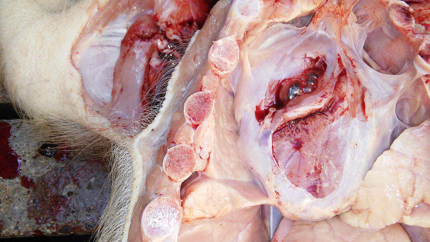 <p>Ryc 5. Pericarditis (zapalenie osierdzia).</p>
