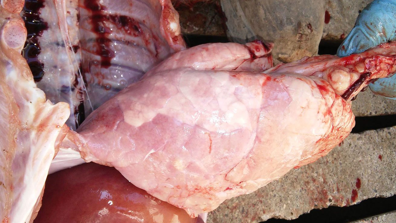 <p>Ryc 7. Śr&oacute;dmiąższowe zapalenie płuc ze stwardnieniem płata przeponowego</p>
