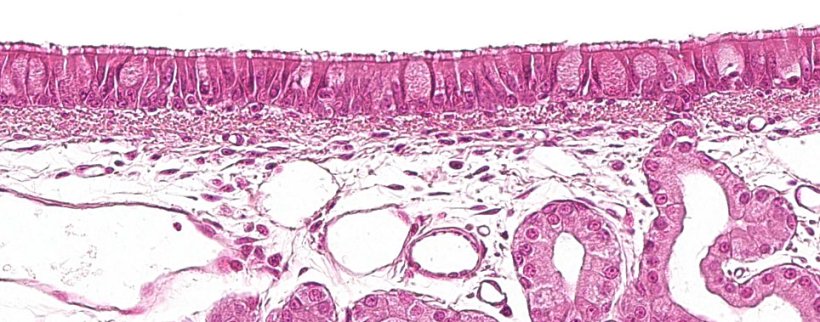 Ryc. 1: Nabłonek wielorzędowy urzęsiony z kom&oacute;rkami kubkowymi, charakterystyczny dla układu oddechowego.
