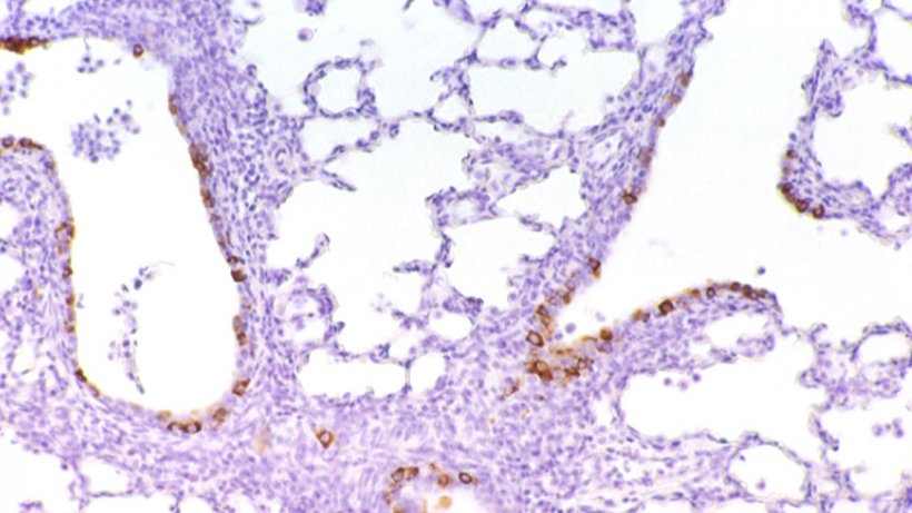 Rycina 6: Kom&oacute;rki znakowane immunologicznie dla PRCV w nabłonku oskrzeli
