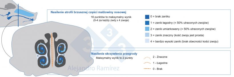 Metoda oceny zmian w małżowinie nosowej według Farmakopei Europejskiej
