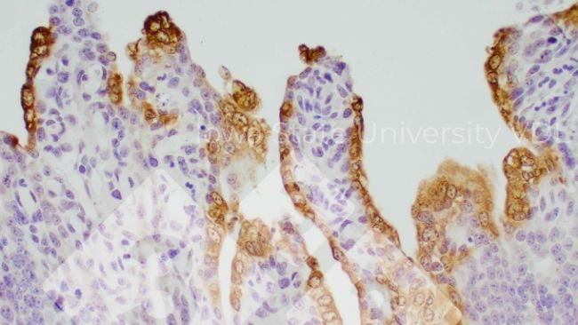 Zdjęcie 1.Barwienie IHC jelita cienkiego zainfekowanego PEDV Źródło: Iowa State University VDL.