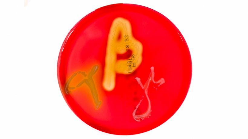 Ryc. 1. Hodowle na szalkach Petriego na agarze z krwią wykazujące hemolizę alfa, beta i gamma. Źr&oacute;dło:&nbsp;Mibilehr https://creativecommons.org/licenses/by-sa/4.0/deed.ene&nbsp;
