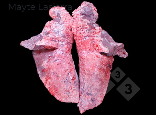 Proces oskrzelowo-płucny