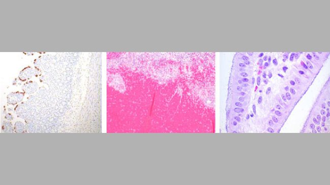 Rotavirus, E.coli i Clostridium perfringens
